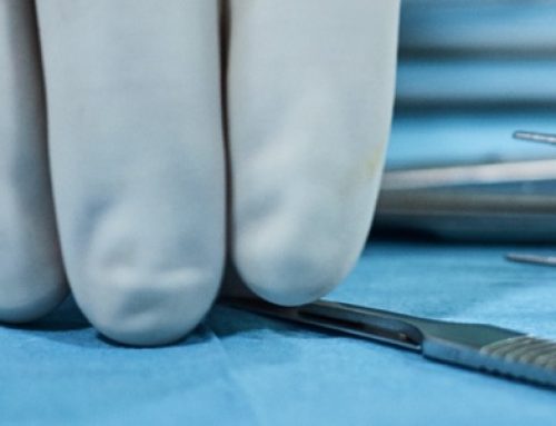 Laparoscopy